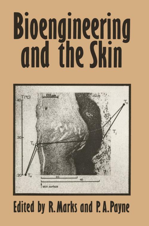 Cover of the book Bioengineering and the Skin by R. Marks, Springer Netherlands