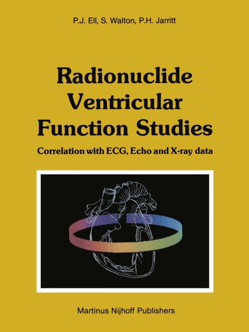 Cover of the book Radionuclide Ventricular Function Studies by P.J. Ell, Stephen Walton, Peter H. Jarritt, Springer Netherlands