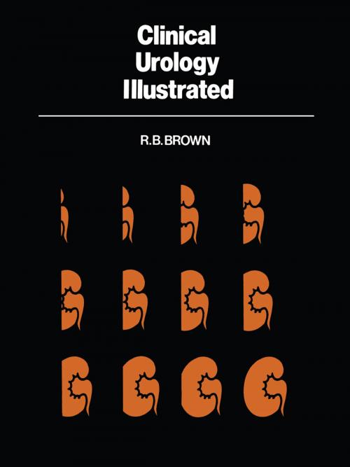 Cover of the book Clinical Urology Illustrated by R.B. Brown, Springer Netherlands