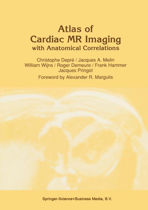 Cover of the book Atlas of Cardiac MR Imaging with Anatomical Correlations by C. Depré, J.A. Melin, W. Wijns, R. Demeure, F. Hammer, J. Pringot, Springer Netherlands