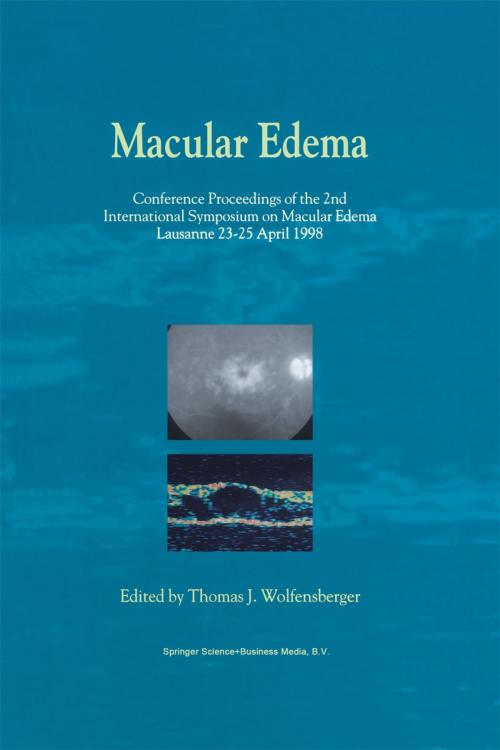 Cover of the book Macular Edema by , Springer Netherlands