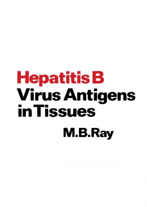 Cover of the book Hepatitis B Virus Antigens in Tissues by M.B. Ray, Springer Netherlands