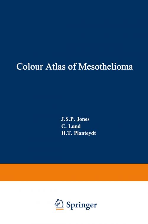 Cover of the book Colour Atlas of Mesothelioma by J.S.P. Jones, C. Lund, H.T. Planteydt, Springer Netherlands