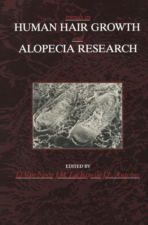 Cover of the book Trends in Human Hair Growth and Alopecia Research by , Springer Netherlands