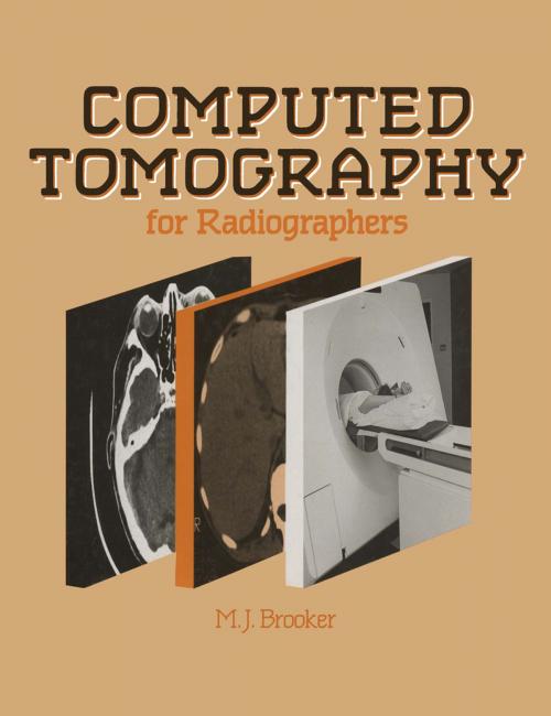 Cover of the book Computed Tomography for Radiographers by M.J. Brooker, Springer Netherlands