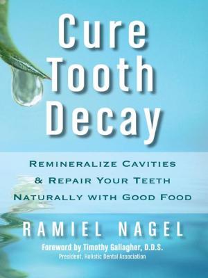 Cover of the book Cure Tooth Decay: Remineralize Cavities and Repair Your Teeth Naturally with Good Food [Second Edition] by DDS Robert Kulacz, MD JD Levy