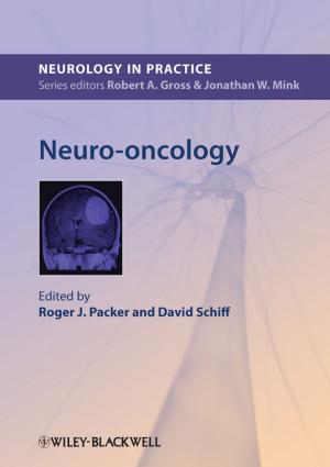 Cover of the book Neuro-oncology by Naomi J. Alpern, Joey Alpern, Randy Muller
