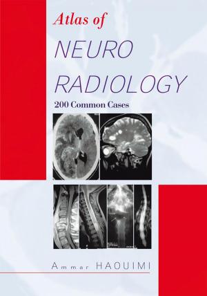 Cover of the book Atlas of Neuroradiology by Jason Flick