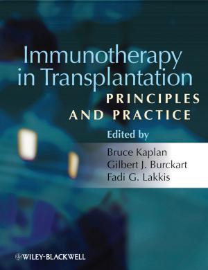 Cover of the book Immunotherapy in Transplantation by Anand Swaminathan, Jürgen Meffert
