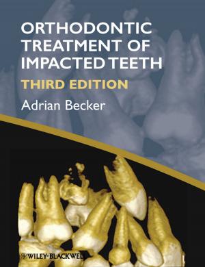 Cover of the book Orthodontic Treatment of Impacted Teeth by Christopher Johns