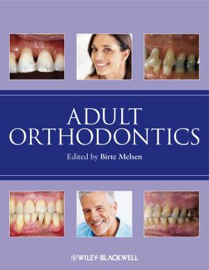 Cover of the book Adult Orthodontics by Steven Hernandez, Adam Gordon