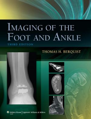 Cover of the book Imaging of the Foot and Ankle by Richard G. Bachur, Kathy N. Shaw