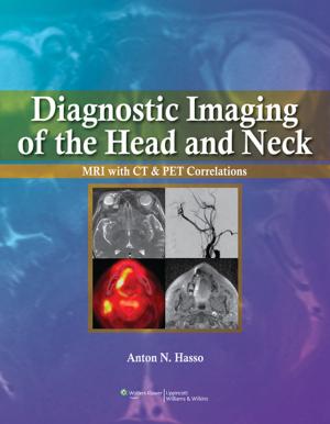 bigCover of the book Diagnostic Imaging of the Head and Neck by 
