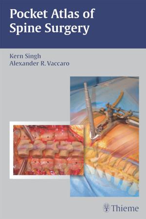 Cover of the book Pocket Atlas of Spine Surgery by Michael Schuenke, Eric W. Baker, Erik Schulte