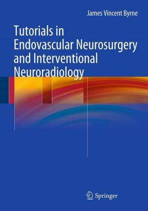 Cover of the book Tutorials in Endovascular Neurosurgery and Interventional Neuroradiology by Angelo Favini, Gabriela Marinoschi
