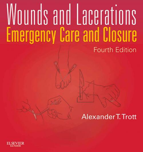 Cover of the book Wounds and Lacerations - E-Book by Alexander T. Trott, MD, Elsevier Health Sciences