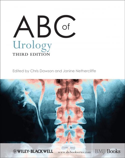 Cover of the book ABC of Urology by Chris Dawson, Janine Nethercliffe, Wiley