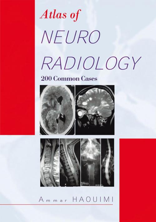 Cover of the book Atlas of Neuroradiology by Ammar Haouimi, Trafford Publishing