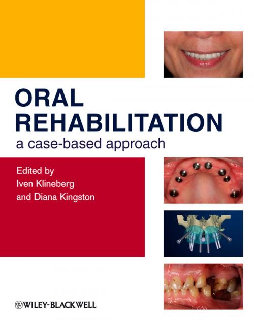 Cover of the book Oral Rehabilitation by , Wiley