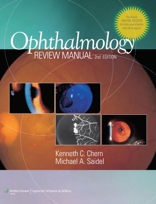 Cover of the book Ophthalmology Review Manual by Kenneth C. Chern, Michael A. Saidel, Wolters Kluwer Health