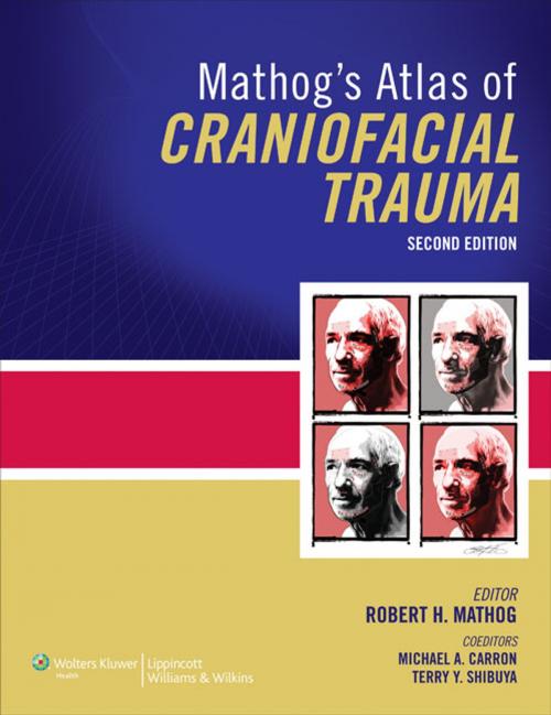 Cover of the book Mathog's Atlas of Craniofacial Trauma by Robert H Mathog, Terry Shibuya, Michael A. Carron, Wolters Kluwer Health