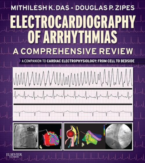 Cover of the book Electrocardiography of Arrhythmias: A Comprehensive Review E-Book by Mithilesh Kumar Das, MD, Douglas P. Zipes, MD, Elsevier Health Sciences