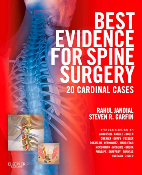 Cover of the book Best Evidence for Spine Surgery E-Book by Rahul Jandial, MD, PhD, Steven R. Garfin, MD, Elsevier Health Sciences