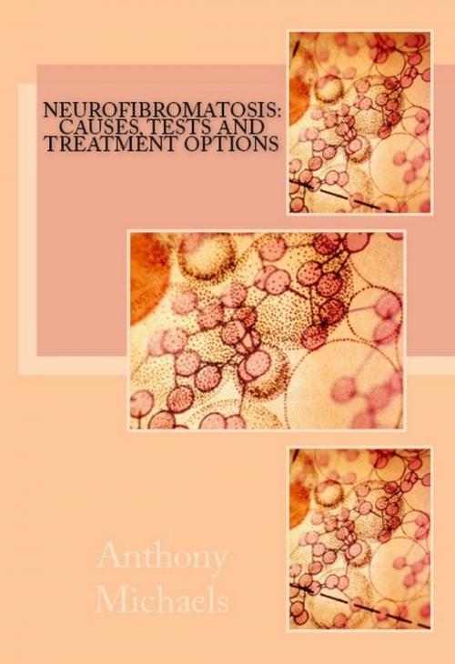 Cover of the book Neurofibromatosis: Causes, Tests and Treatment Options by Anthony Michaels, Andale LLC