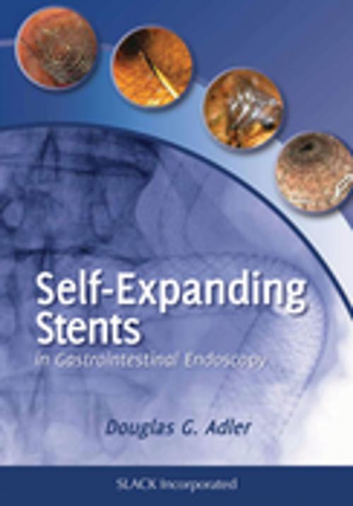 Cover of the book Self Expanding Stents in Gastroenterology by Douglas Adler, SLACK Incorporated