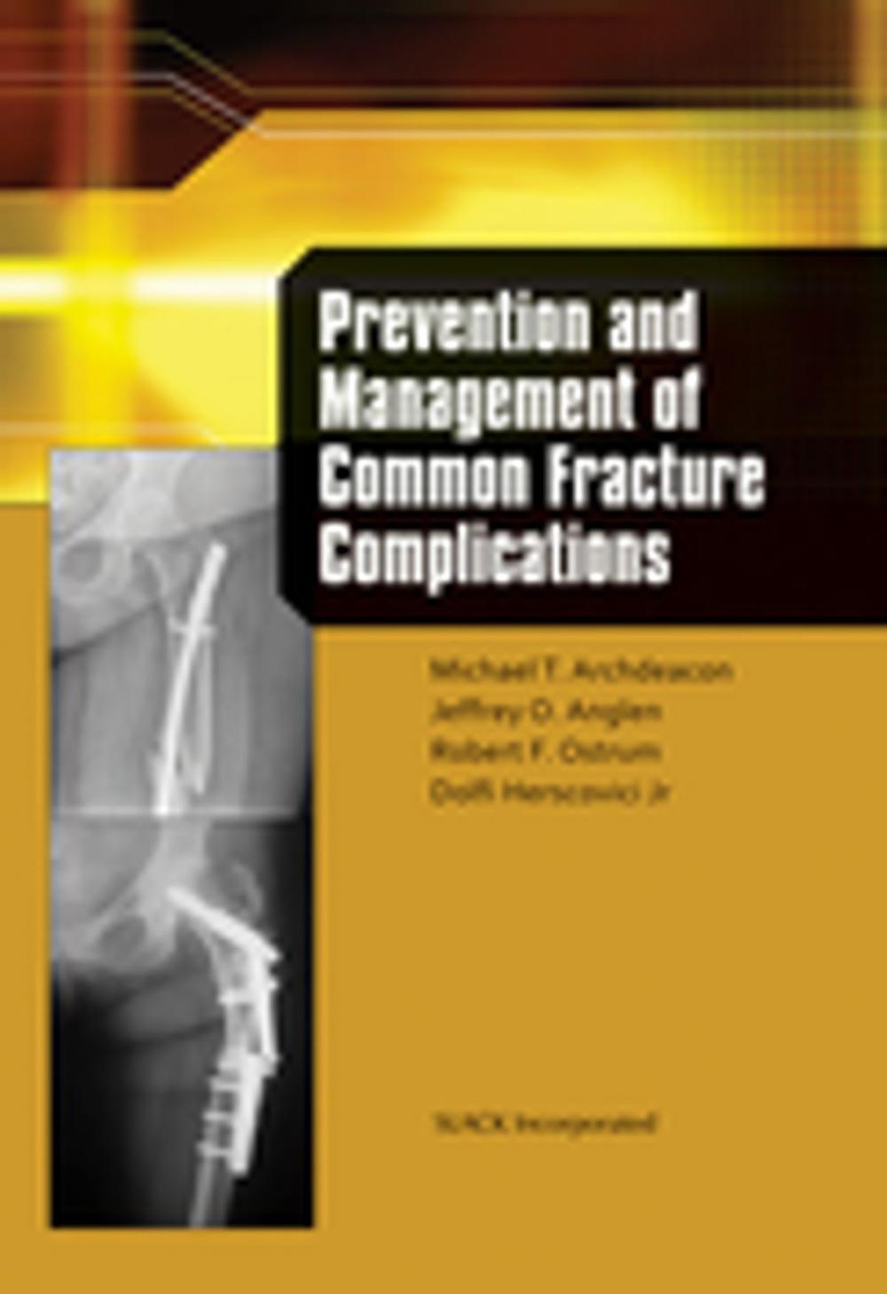 Big bigCover of Prevention and Management of Common Fracture Complications