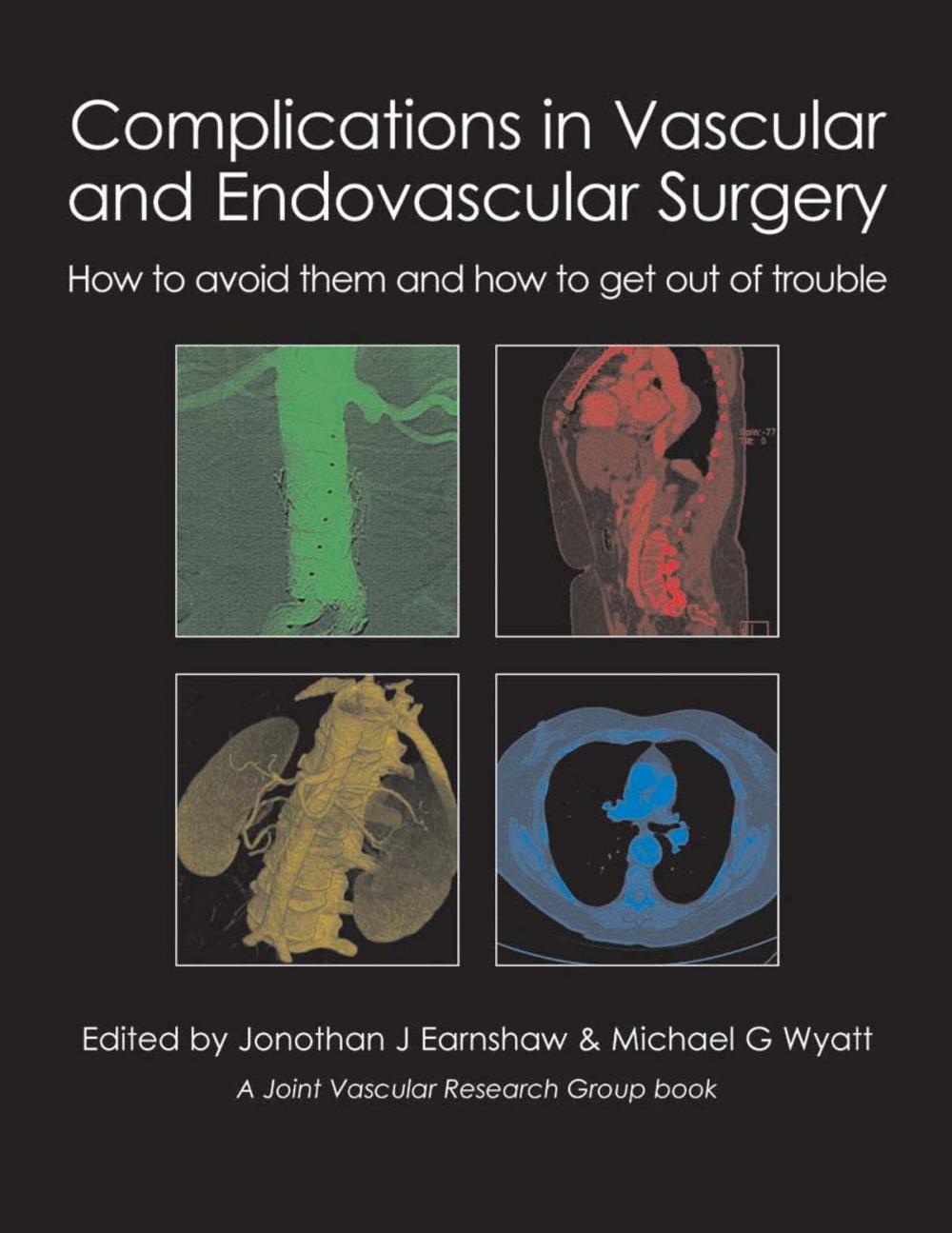 Big bigCover of Complications in Vascular and Endovascular Surgery