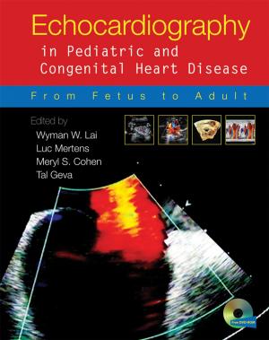 Cover of the book Echocardiography in Pediatric and Congenital Heart Disease by Graham Harman