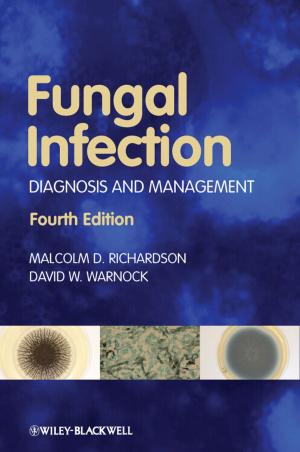 Book cover of Fungal Infection