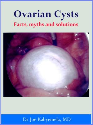 Book cover of Ovarian Cysts A-Z: Facts, myths and solutions