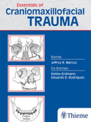 Cover of the book Essentials of Craniomaxillofacial Trauma by Christopher Herzog, Francis A. Burgener