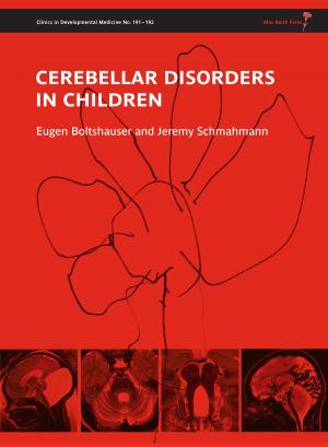 Cover of the book Cerebellar Disorders in Children by Richard W Newton, Liz Marder, Shiela C Puri