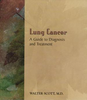 Cover of the book Lung Cancer by Mark Antinoro