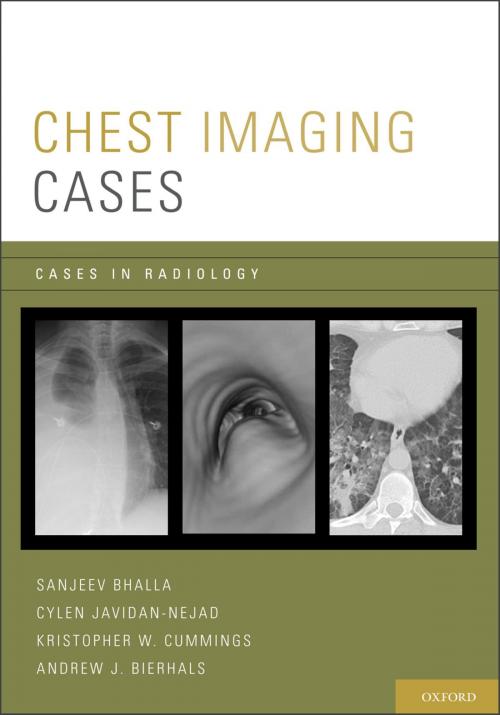 Cover of the book Chest Imaging Cases by Sanjeev Bhalla, Cylen Javidan-Nejad, Kristopher W. Cummings, Andrew J. Bierhals, Oxford University Press