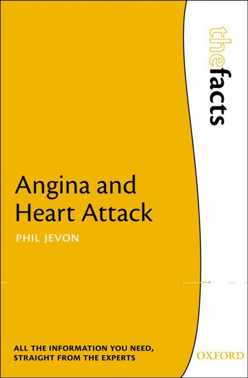 Cover of the book Angina and Heart Attack by Phil Jevon, OUP Oxford