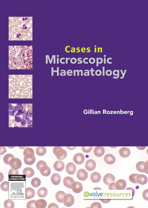 Cover of the book Cases in Microscopic Haematology - E-Book by Gillian Rozenberg, FAMS, Elsevier Health Sciences