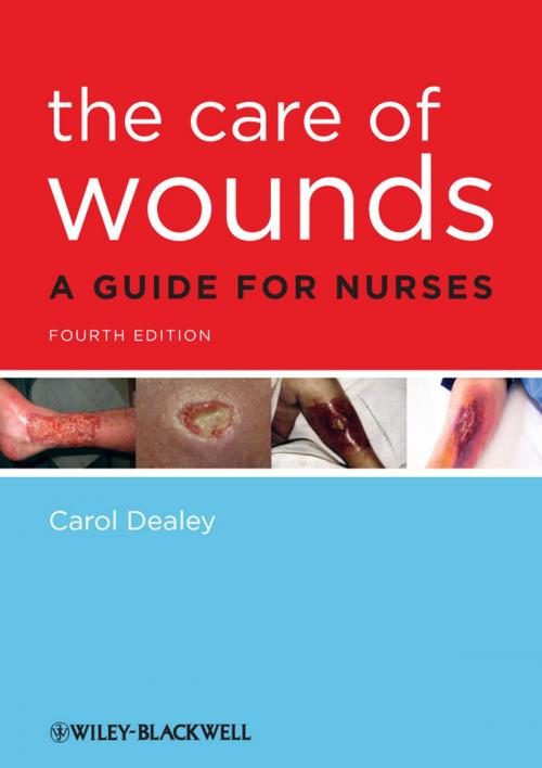 Cover of the book The Care of Wounds by Carol Dealey, Wiley