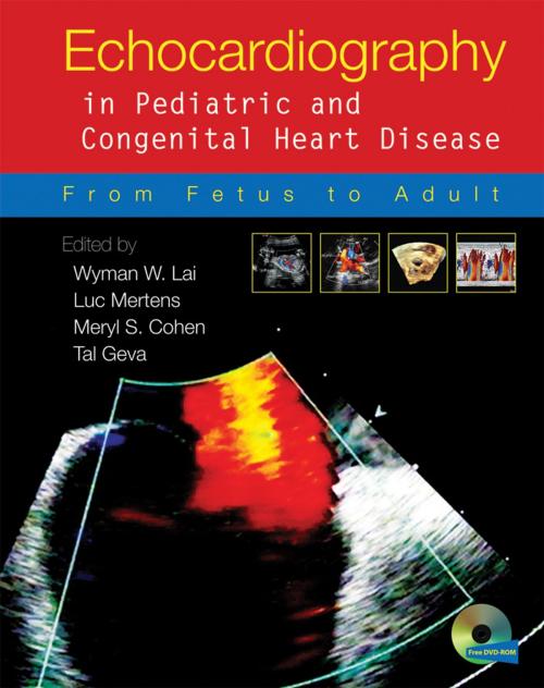 Cover of the book Echocardiography in Pediatric and Congenital Heart Disease by , Wiley