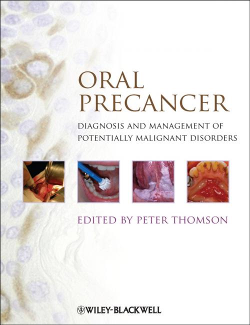 Cover of the book Oral Precancer by , Wiley