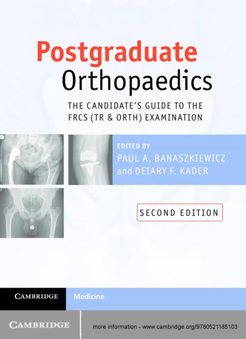 Cover of the book Postgraduate Orthopaedics by , Cambridge University Press