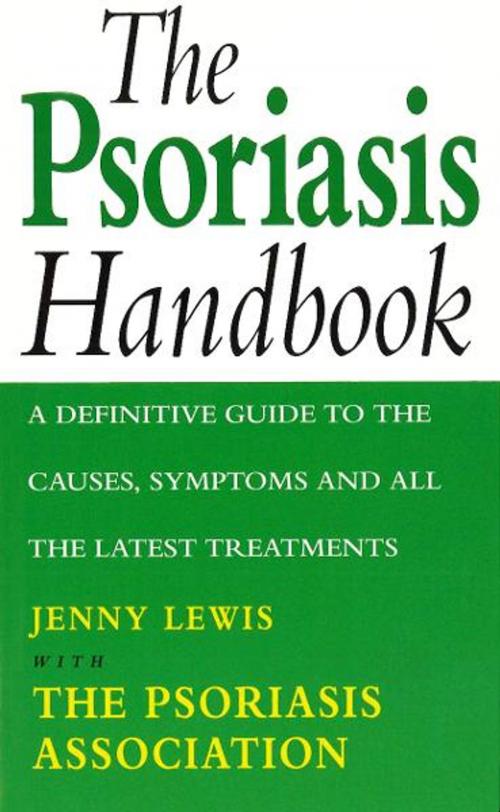 Cover of the book The Psoriasis Handbook by Lewis, Jenny With The Psoriasis Association, Ebury Publishing