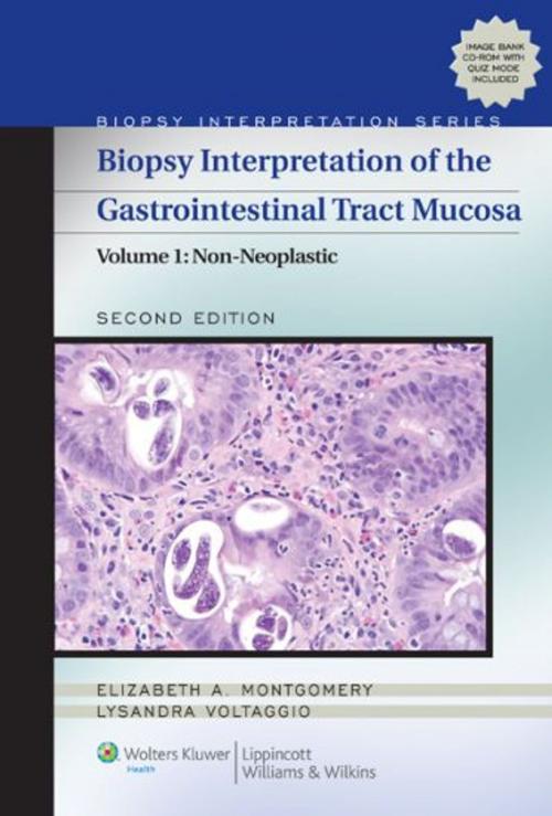 Cover of the book Biopsy Interpretation of the Gastrointestinal Tract Mucosa by Elizabeth A. Montgomery, Lysandra Voltaggio, Wolters Kluwer Health