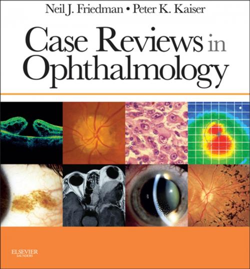Cover of the book Case Reviews in Ophthalmology E-Book by Neil J. Friedman, Peter K. Kaiser, MD, Elsevier Health Sciences