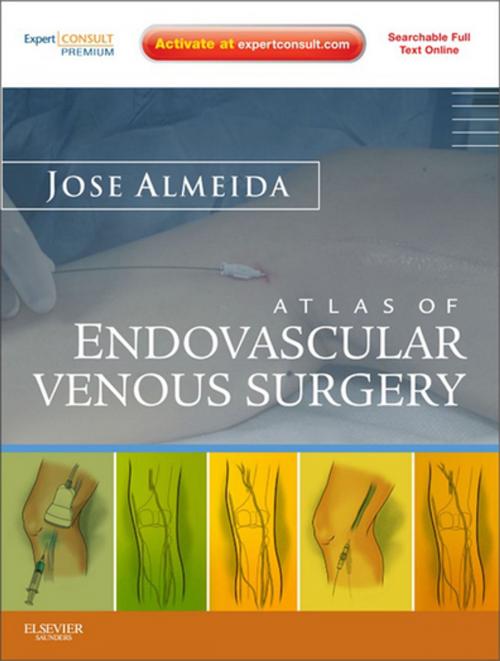 Cover of the book Atlas of Endovascular Venous Surgery E-Book by Jose Almeida, MD, PA, Elsevier Health Sciences