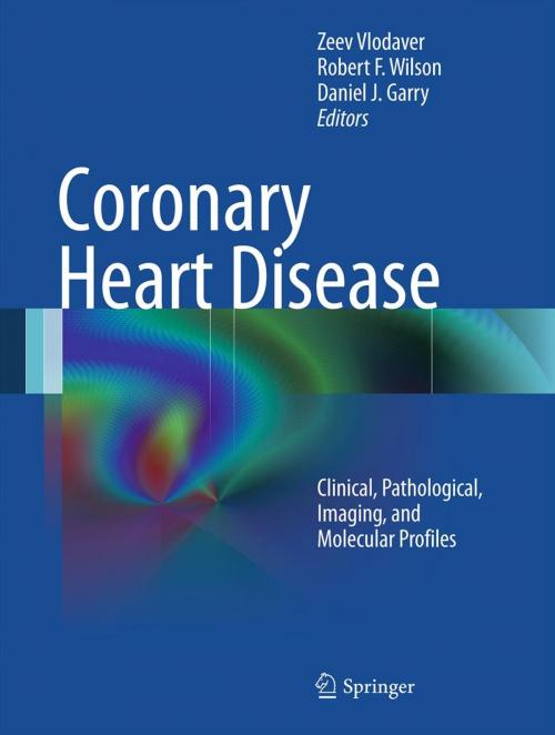 Cover of the book Coronary Heart Disease by , Springer US