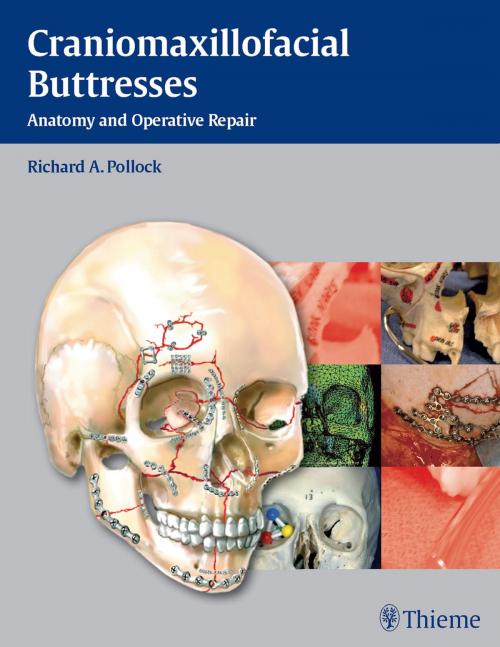 Cover of the book Craniomaxillofacial Buttresses by , Thieme